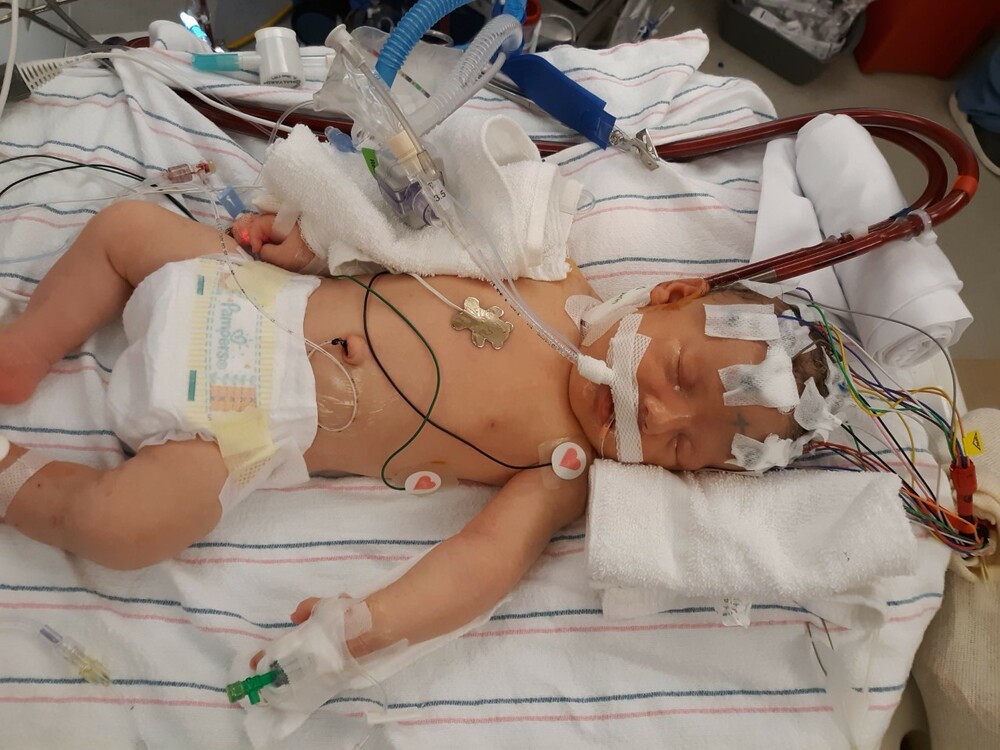 Donate to Fight Congenital Diaphragmatic Hernia